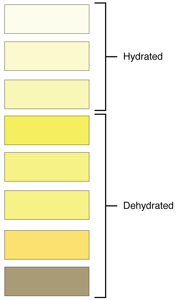 This color chart shows different shades of yellow and associates each shade with hydration or dehydration.