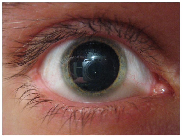 miotic pupil drug related