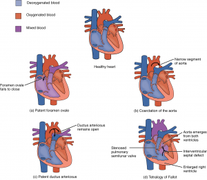 19.1 Heart Anatomy – Anatomy & Physiology