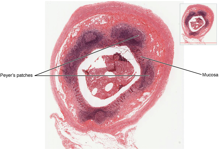 This figure shows a micrograph of a mucosa associated lymphoid tissue nodule.