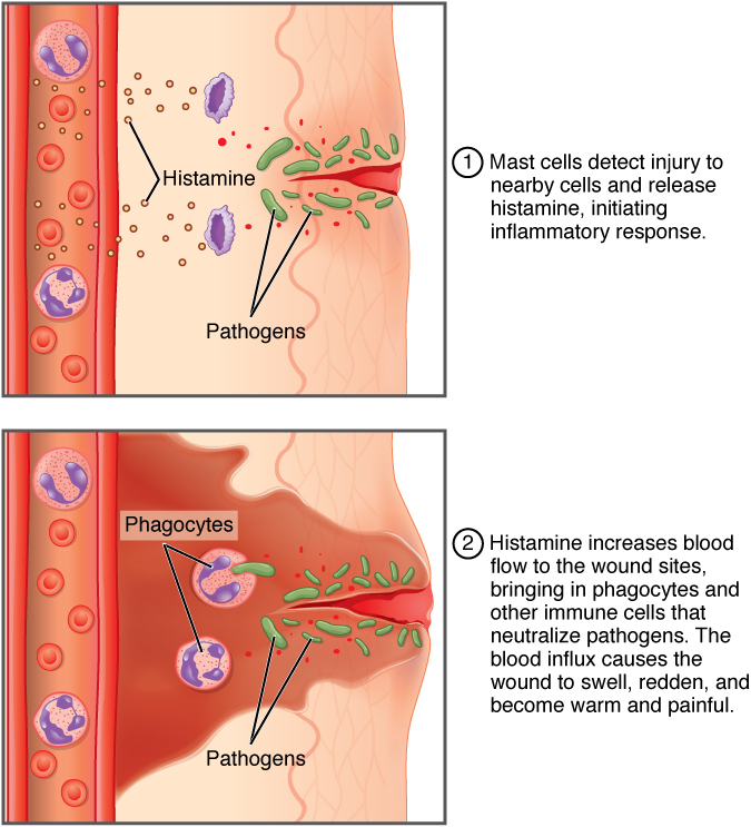 The top panel of this figure shows the mast cells detecting an injury and initiating an inflammatory response. The bottom panel shows the increase in blood flow in response to histamine.