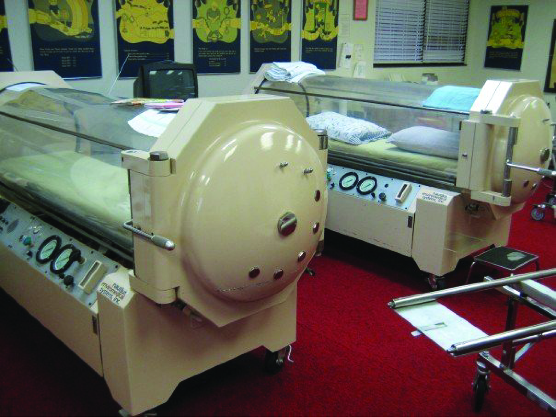 This photo shows two hyperbaric chambers.