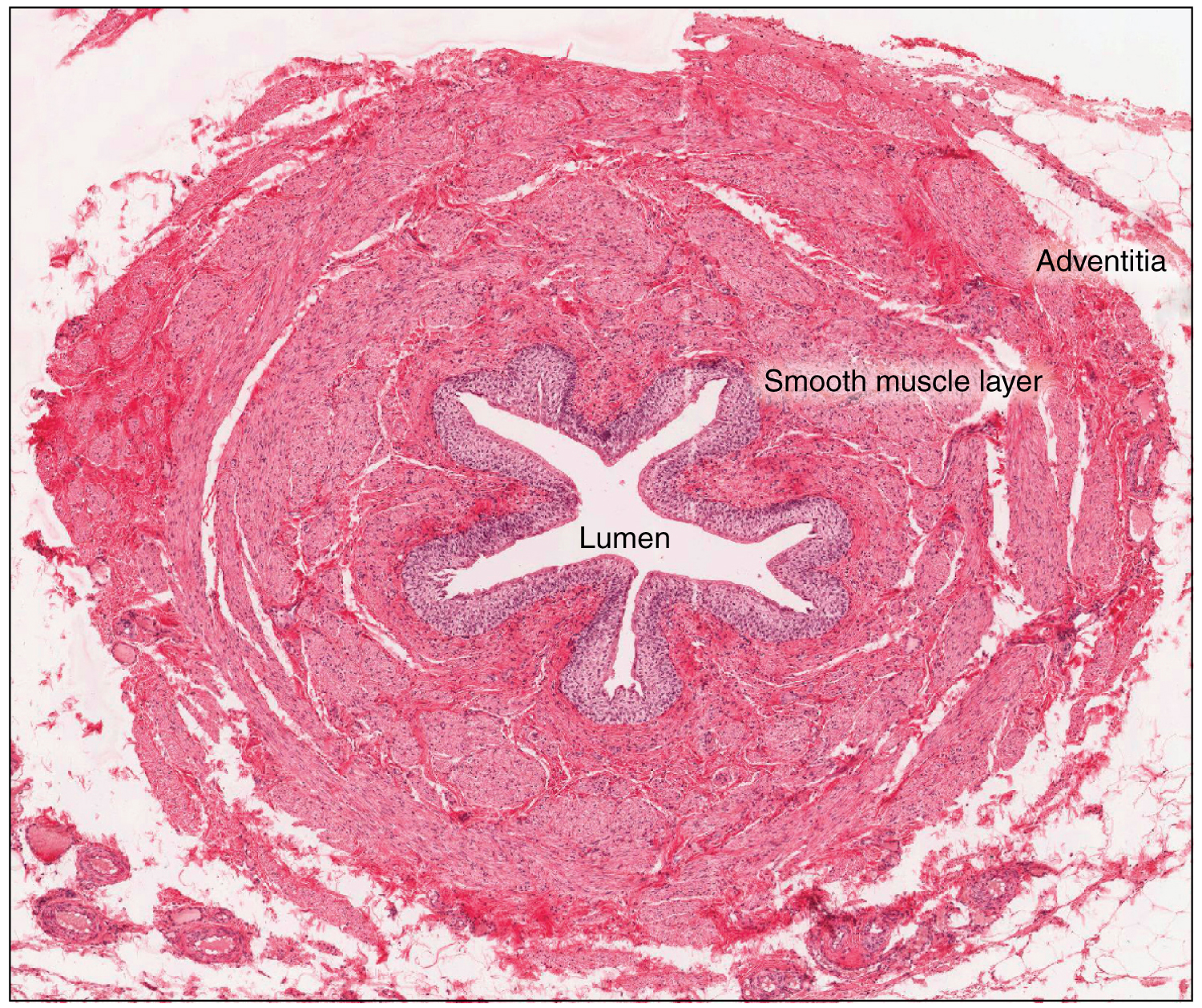 A micrograph shows the lumen of the ureter.
