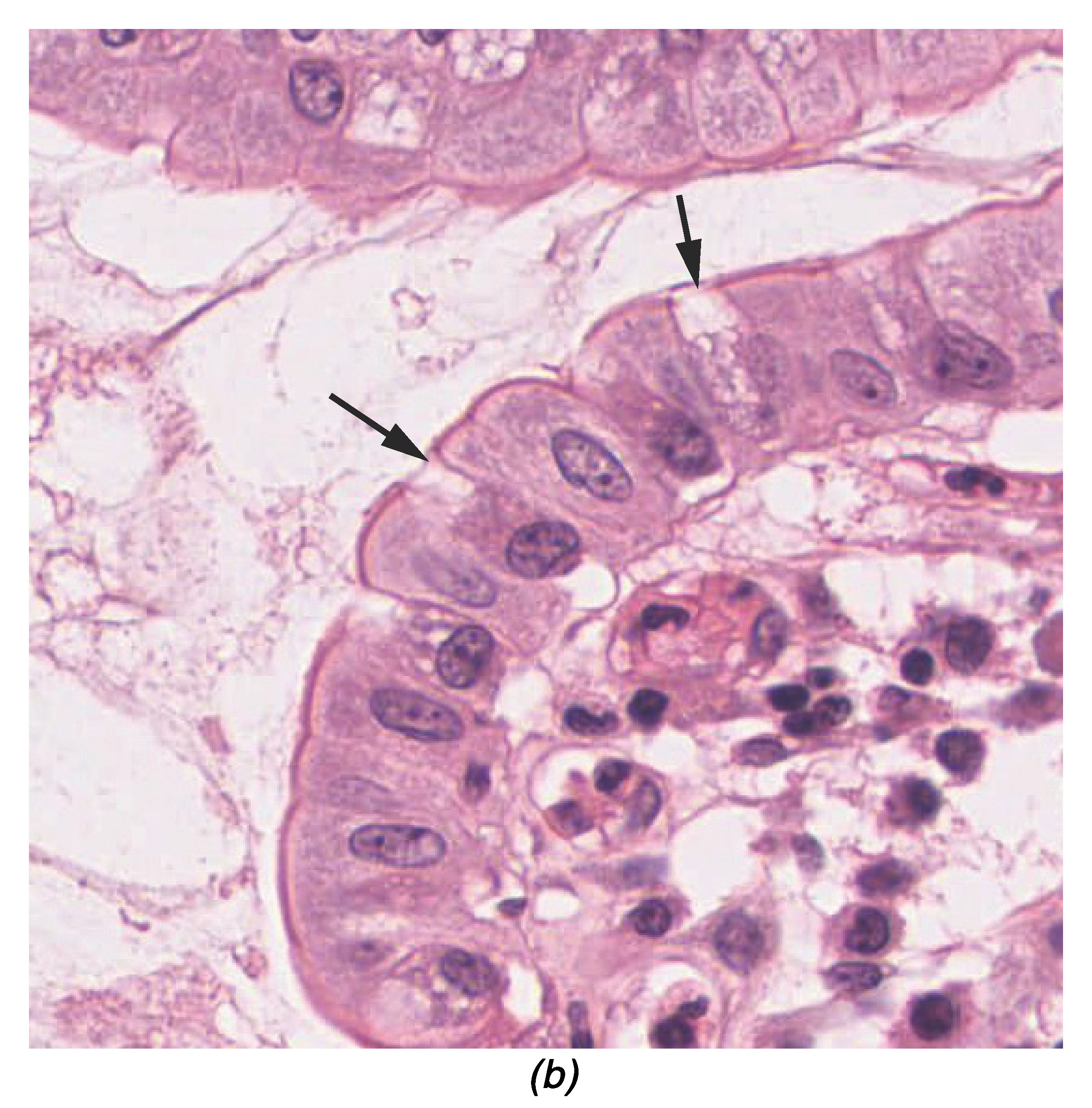 The second image is a micrograph of the innermost lining of the small intestine. This innermost lining is a simple columnar epithelium, with a single layer of rectangular cells oriented in a line. Occasionally, the line of epithelial cells is interrupted by a goblet cell. Goblet cells are thinner than the epithelial cells and appear roughly pill shaped. In this micrograph, the cells did not stain as darkly as the epithelial cells.