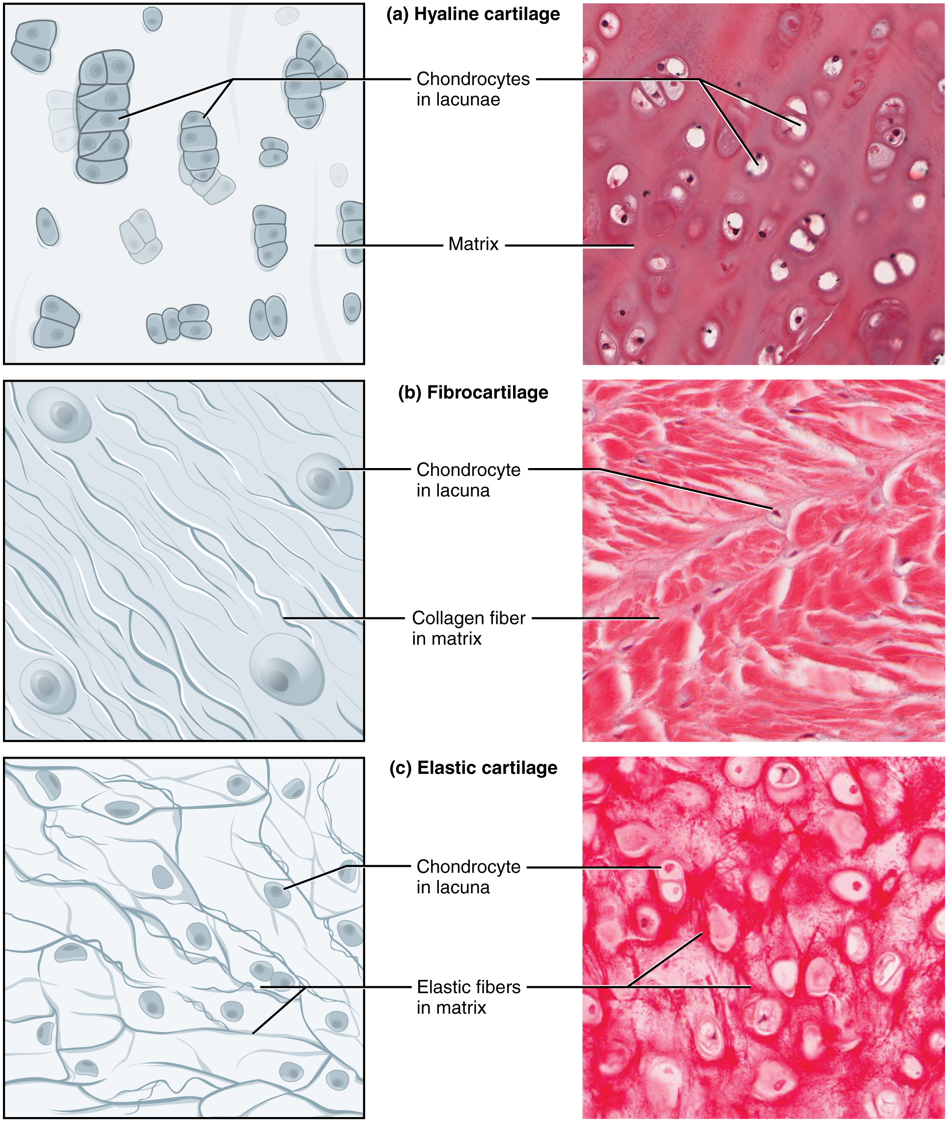 Part A of this diagram is a drawing and a micrograph of hyaline cartilage. The cartilage contains chondrocytes encapsulated in lacunae. Several of the lacunae are joined into groups or small stacks and embedded in the surrounding matrix. The micrograph shows the lacunae as white rings surrounding the purple staining chondrocytes. Some occur as joined pairs while others are embedded singly within the pink staining matrix. Image B shows a diagram and a micrograph of fibrocartilage that contains many fine collagen fibers embedded in the matrix. The collagen fibers are roughly parallel to each but run through the matrix in a wavy fashion. There are also four round chondrocyte cells embedded within the matrix. In the micrograph, the matrix is shaded red and the collagen fibers are visible in white. The lacunae are clearly visible as a faint purple ring containing several dark purple chondrocytes. Part C shows a diagram and micrograph of elastic cartilage. In the diagram, fine elastic fibers are seen crisscrossing the matrix. Many of the elastic fibers branch off from each other, unlike the collagen fibers depicted in parts A and B. The lacunae are clearly visible as white rings containing stained chondrocytes. The fibers stain deeply in this micrograph and can been seen crisscrossing through the tissue.