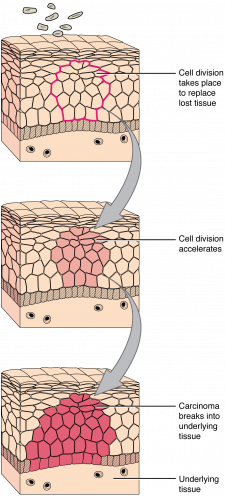 4.6 Tissue Injury and Aging – Anatomy & Physiology