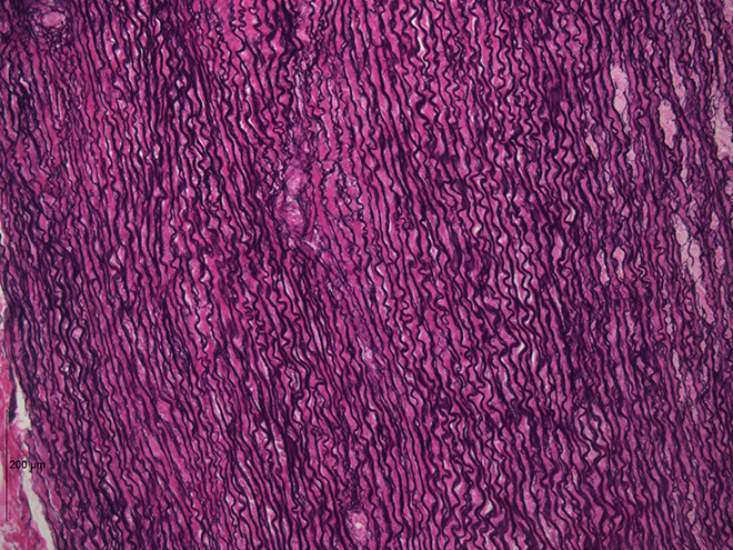 loose connective tissue under microscope