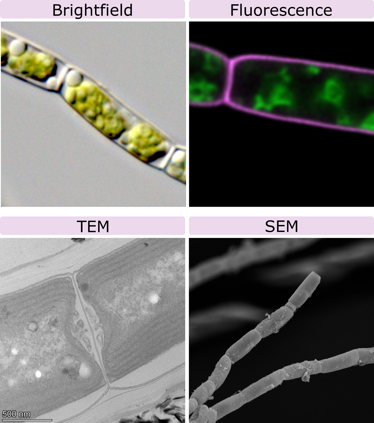 Four types of micrographs of the same type of algal cells.