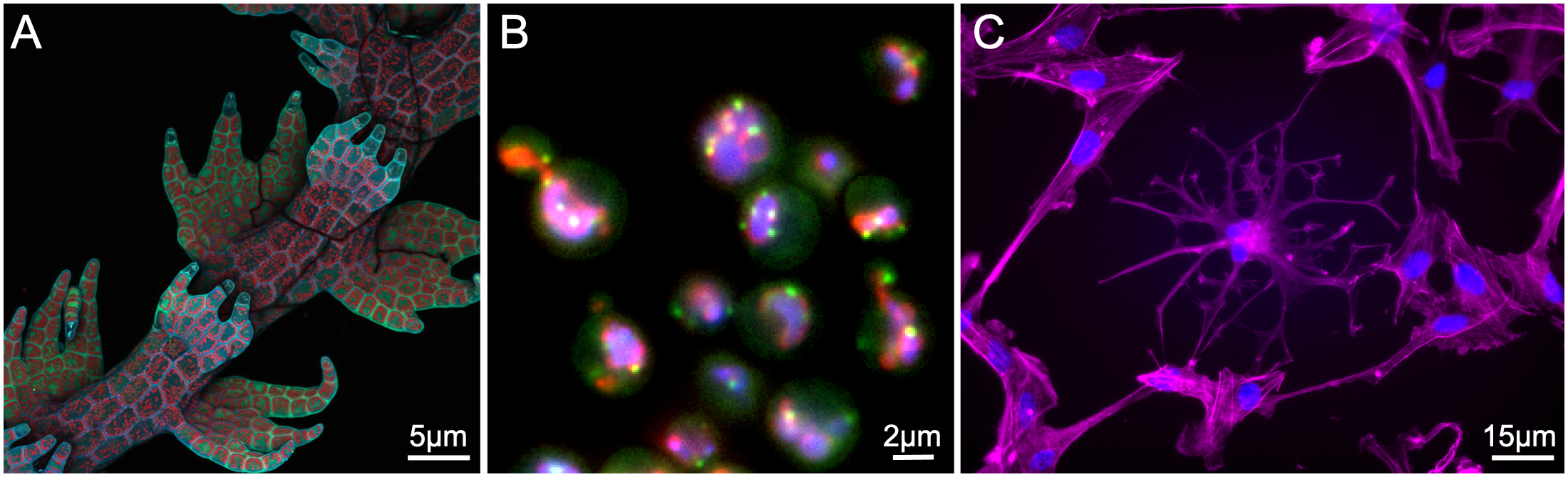 Three fluorescence micrographs of different cell types.