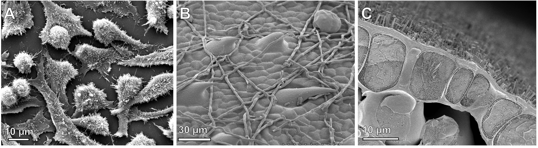 Three SEM micrographs from various cell types.