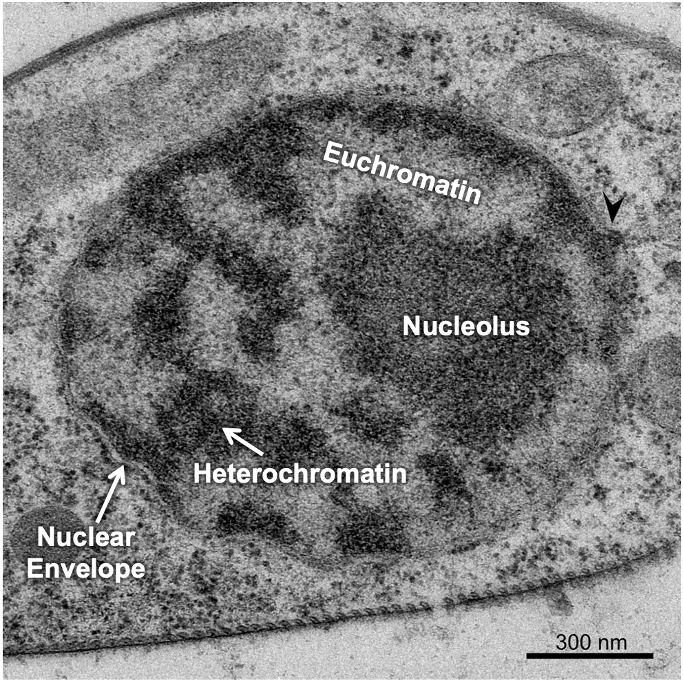 TEM micrograph of a nucleus with labelled euchromatin, heterochromatin, nuclear envelope and nucleolus