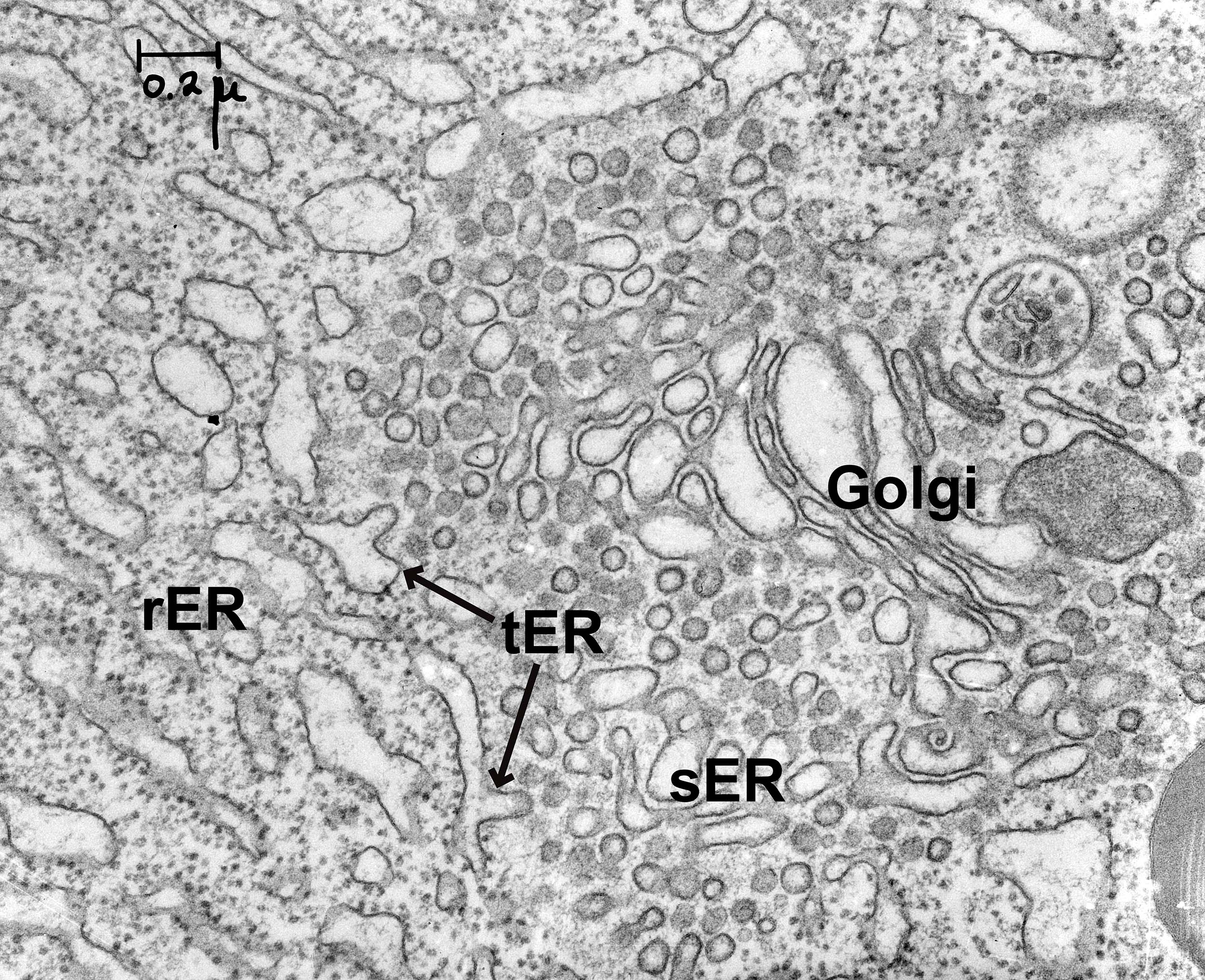 Electron micrograph of the rough and smooth ER along with the Golgi