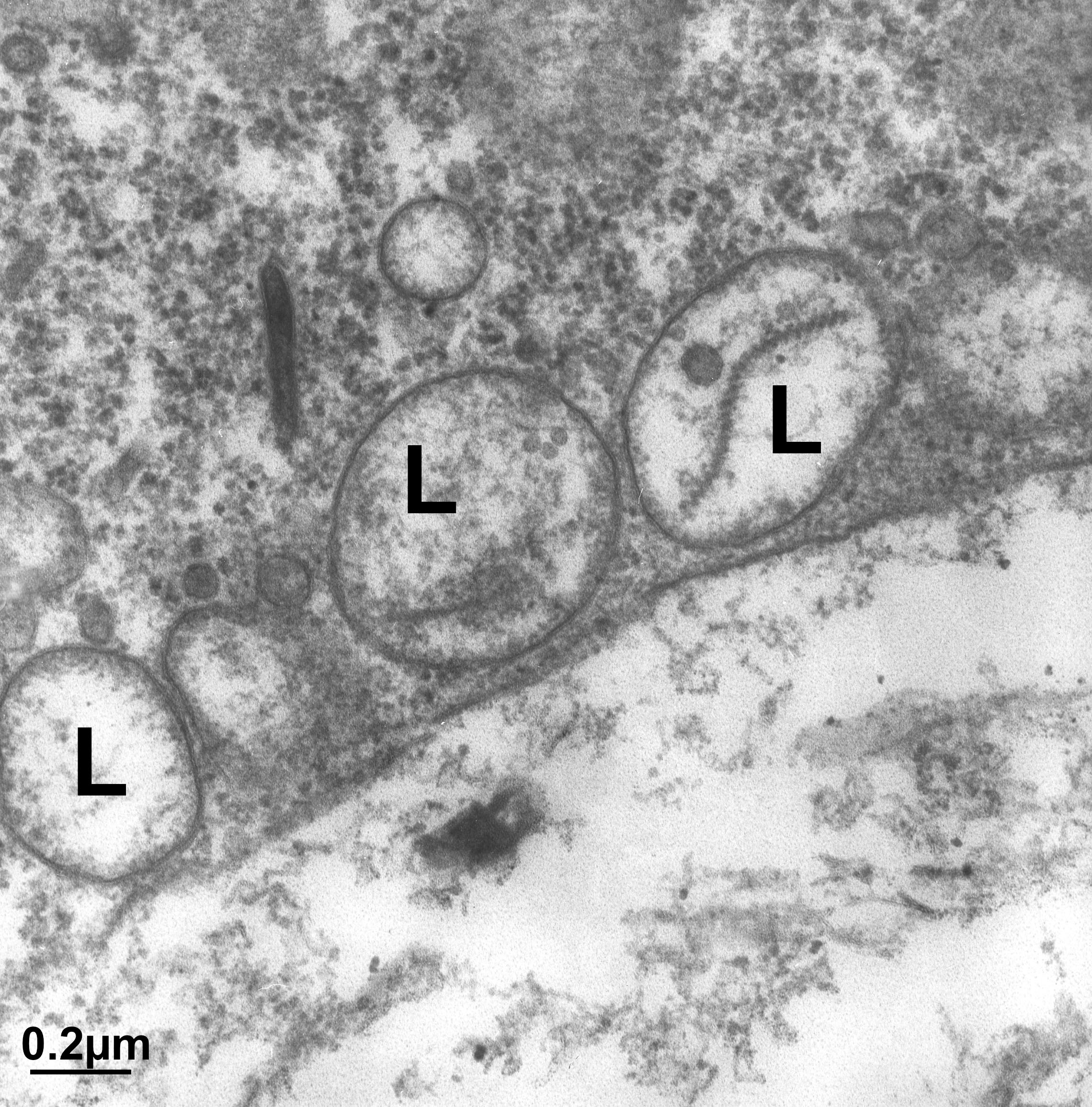 Three lysosomes (each labelled 'L')