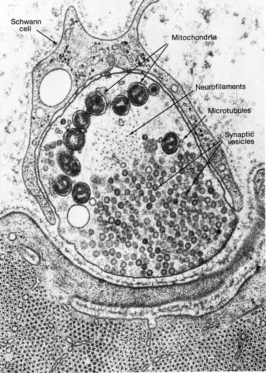 TEM cross section of a frog neuron, at the edge of a neuromuscular junction