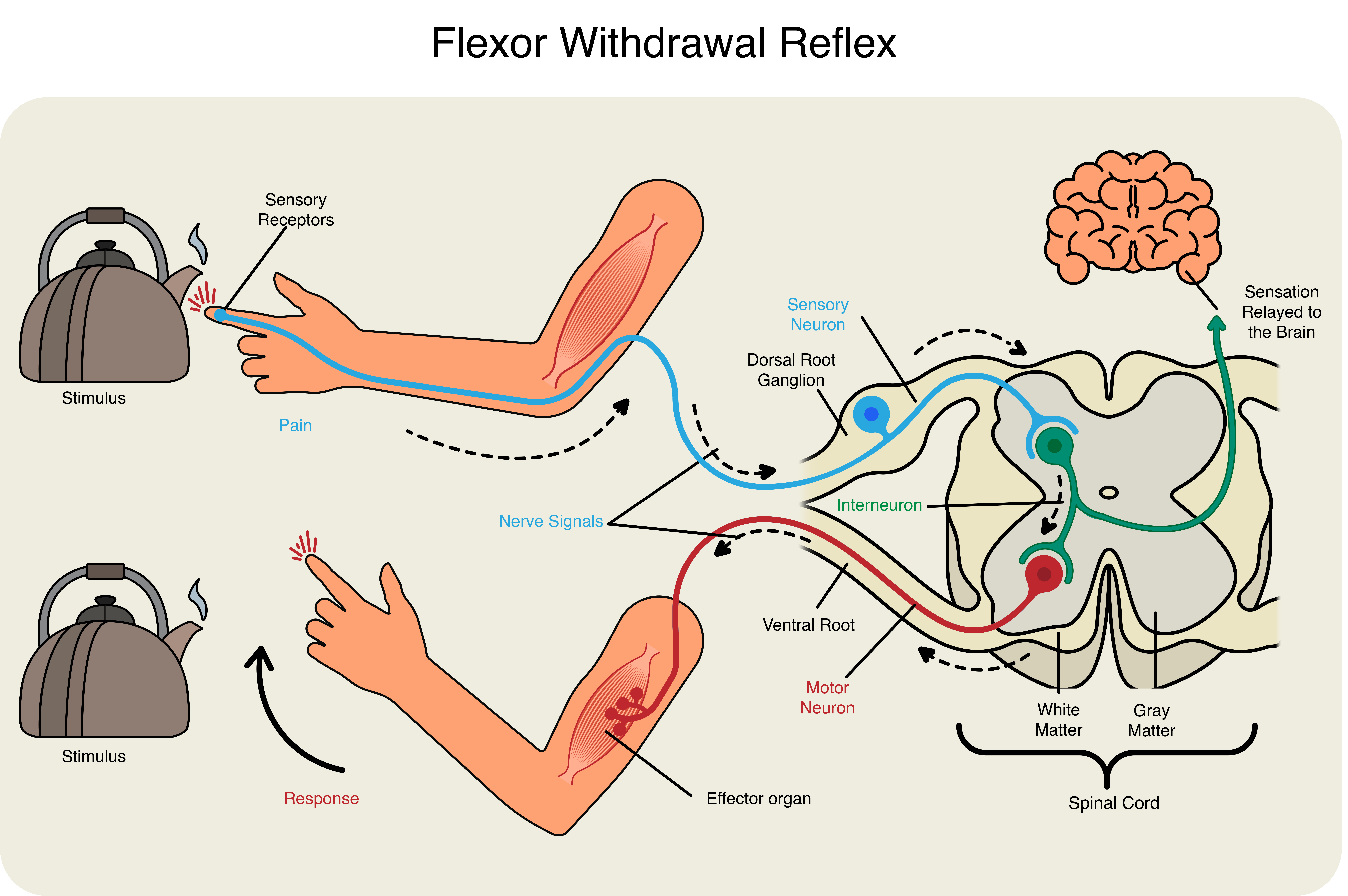 Illustration showing the flexor withdrawal reflex. A hot kettle (stimulus) triggers sensory receptors in the hand, which sends signals (nerve) to the spinal cord, where it is carried to a motor neuron by an interneuron. The motor neuron replays the signal to the effector muscle, which causes the hand to withdraw. A parallel signal is relayed by the interneuron to the brain for sensation awareness.