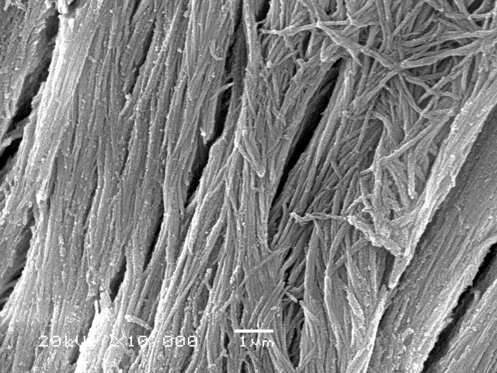 Micrograph of calcified collagen fibers.