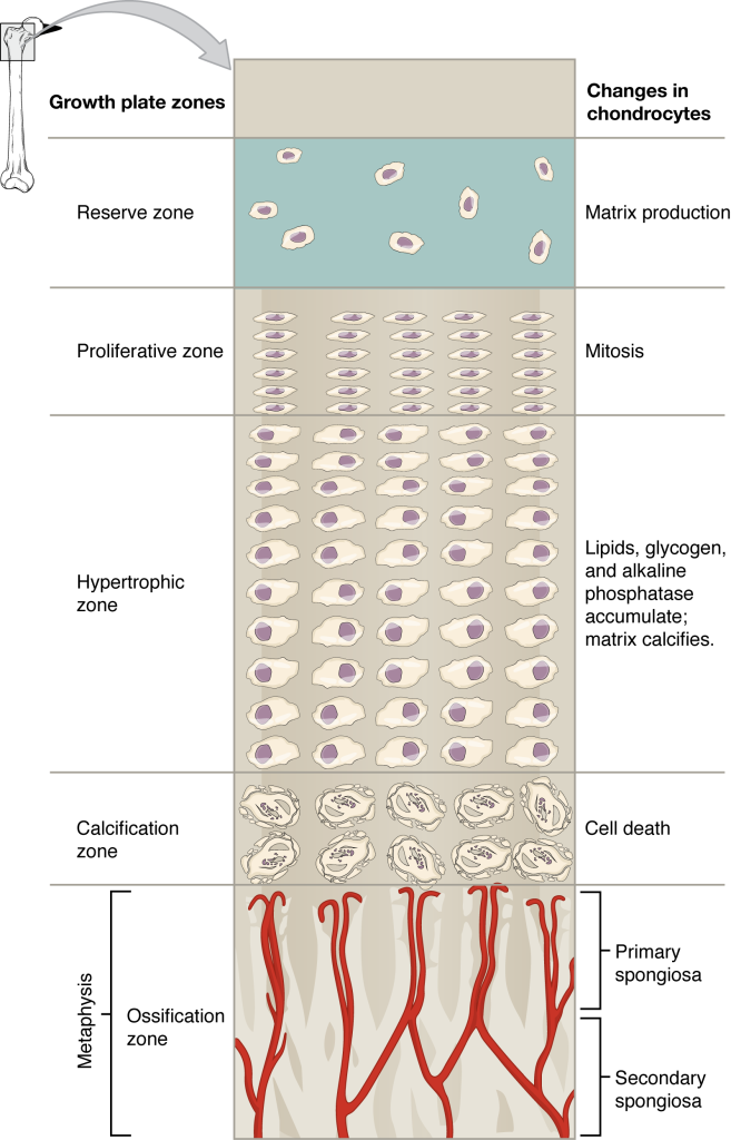 This illustration shows the zones bordering the epiphyseal plate of the epiphysis. The topmost layer of the epiphysis is the reserve zone, which is colored blue because it is made of cartilage. Two arteries are shown travelling through this zone to supply nutrients to the second zone: the proliferative zone. Here, five chondrocytes are undergoing mitosis. They continually divide, producing five long rows of chondrocytes. The next zone is the zone of maturation and hypertrophy. Here, lipids, glycogen and alkaline phosphatase accumulate, causing the cartilaginous matrix to calcify. This zone consists of five rows of ten chondrocytes which are increasing in size as one moves down a row. The next zone is the calcified matrix. Here, the chondrocytes have hardened and die as the matrix around them has calcified. The bottommost row is the zone of ossification. This zone is actually part of the metaphysis. Arteries from the metaphysis branch through the newly-formed trabeculae in this zone. The newly deposited bone tissue at the top of the zone of ossification is called the primary spongiosa. The older bone at the bottom of the zone of ossification is labeled the secondary spongiosa.