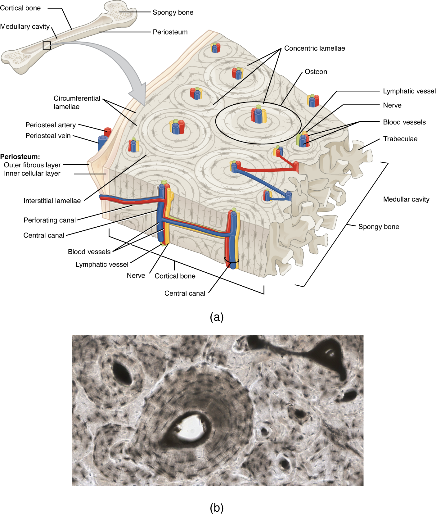 A generic long bone is shown at the top of this illustration. The bone is split in half lengthwise to show its internal anatomy. The outer gray covering of the bone is labeled the periosteum. Within the periosteum is a thin layer of compact bone. The compact bone surrounds a central cavity called the medullary cavity. The medullary cavity is filled with spongy bone at the two epiphyses. A callout box shows that the main image is zooming in on the compact bone on the left side of the bone. On the main image, the periosteum is being peeled back to show its two layers. The outer layer of the periosteum is the outer fibrous layer. This layer has a periosteal artery and a periosteal vein running along its outside edge. The inner layer of the periosteum is labeled the inner osteogenic layer. The compact bone lies to the right of the periosteum and occupies the majority of the main image. Two flat layers of compact bone line the inner surface of the ostegenic periosteum. These sheets of compact bone are called the circumferential lamellae. The majority of the compact bone has lamellae running perpendicular to that of the circumferential lamellae. These concentric lamellae are arranged in a series of concentric tubes. There are small cavities between the layers of concentric lamellae called lacunae. The centermost concentric lamella surrounds a hollow central canal. A blue vein, a red artery, a yellow nerve and a green lymph vessel run vertically through the central canal. A set of concentric lamellae, its associated lacunae and the vessels and nerves of the central canal are collectively called an osteon. The front edge of the diagram shows a longitudinal cross section of one of the osteons. The vessels and nerve are visible running through the center of the osteon throughout its length. In addition, blood vessels can run from the periosteum through the sides of the osteons and connect with the vessels of the central canal. The blood vessels travel through the sides of the osteons via a perforating canal. The open areas between neighboring osteons are also filled with compact bone. This “filler” bone is referred to as the interstitial lamellae. At the far right of the compact bone, the edge of the spongy bone is visible. The spongy bone is a series of crisscrossing bony arches called trabeculae. There are many open spaces between the trabeculae, giving the spongy bone its sponge-like appearance.