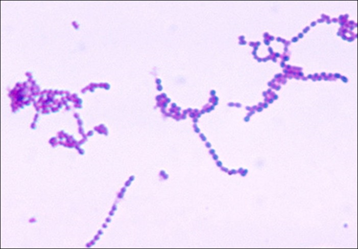 Streptococcus pyogenes forms chains of cocci.