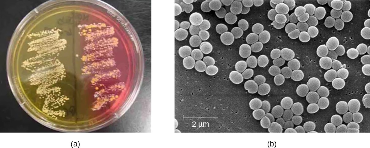 (a) A mannitol salt agar plate is used to distinguish different species of staphylococci. In this plate, S. aureus is on the left and S. epidermidis is in the right. Because S. aureus is capable of fermenting mannitol, it produces acids that cause the color to change to yellow. (b) This scanning electron micrograph shows the characteristic grapelike clusters of S. aureus.