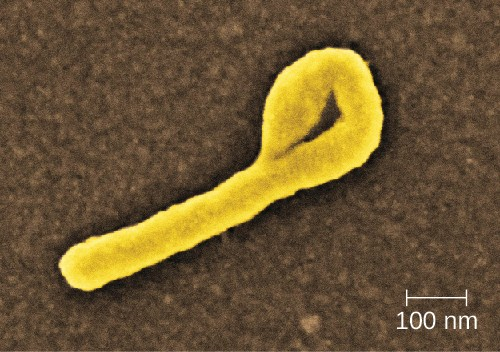 An Ebola virus particle viewed with electron microscopy. These filamentous viruses often exhibit looped or hooked ends.