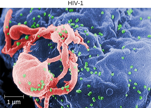 This micrograph shows HIV particles (green) budding from a lymphocyte (top right).