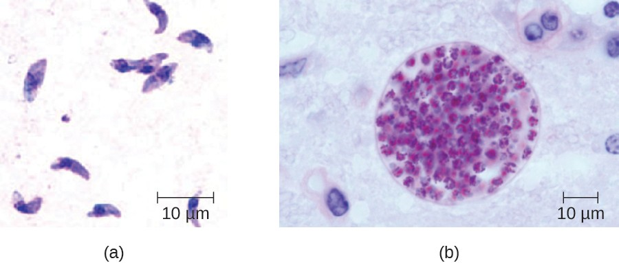 (a) Giemsa-stained Toxoplasma gondii tachyzoites from a smear of peritoneal fluid obtained from a mouse inoculated with T. gondii. Tachyzoites are typically crescent shaped with a prominent, centrally placed nucleus. (b)  Microscopic cyst containing T. gondii from mouse brain tissue. Thousands of resting parasites (stained red) are contained in a thin parasite cyst wall.