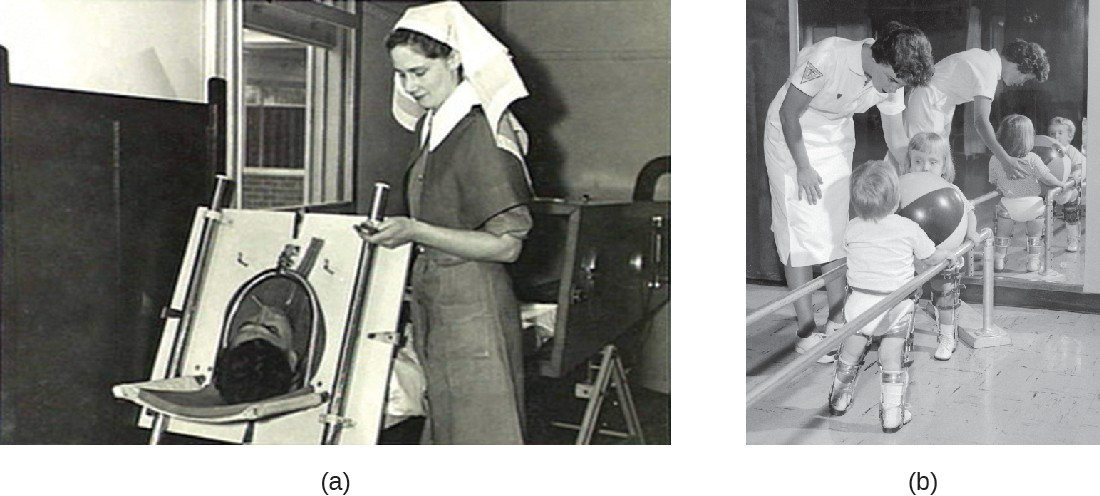 (a) An Emerson respiratory (or iron lung) that was used to help some polio victims to breathe. (b) Polio can also result in impaired motor function.