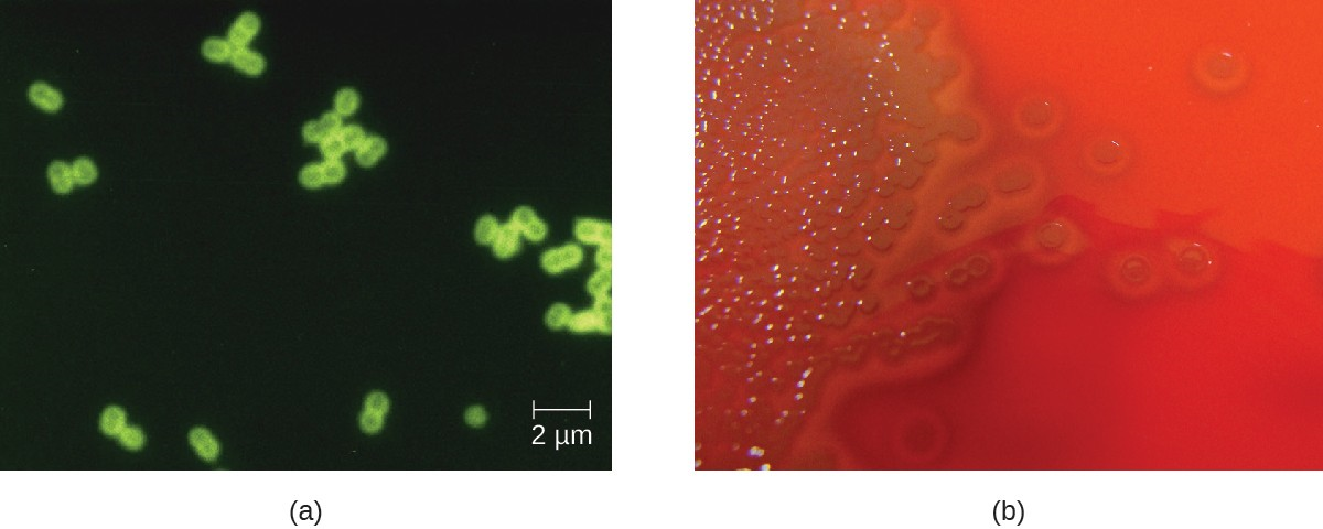 (a) Digitally colorized fluorescent antibody stained micrograph of Streptococcus pneumoniae in CSF. (b) S. pneumoniae growing on blood agar.