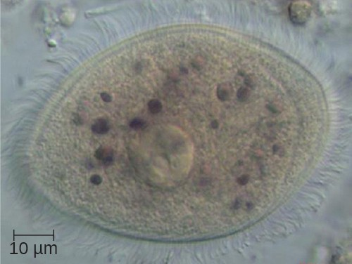 This specimen of the ciliate Balantidium coli is a trophozoite form isolated from the gut of a primate. B. coli is the only ciliate capable of parasitizing humans.