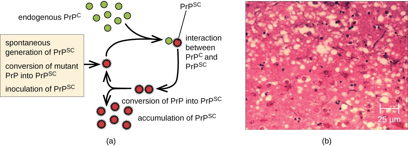Endogenous normal prion protein (PrPc) is converted into the disease-causing form (PrPsc) when it encounters this variant form of the protein. PrPsc may arise spontaneously in brain tissue, especially if a mutant form of the protein is present, or it may originate from misfolded prions consumed in food that eventually find their way into brain tissue.
