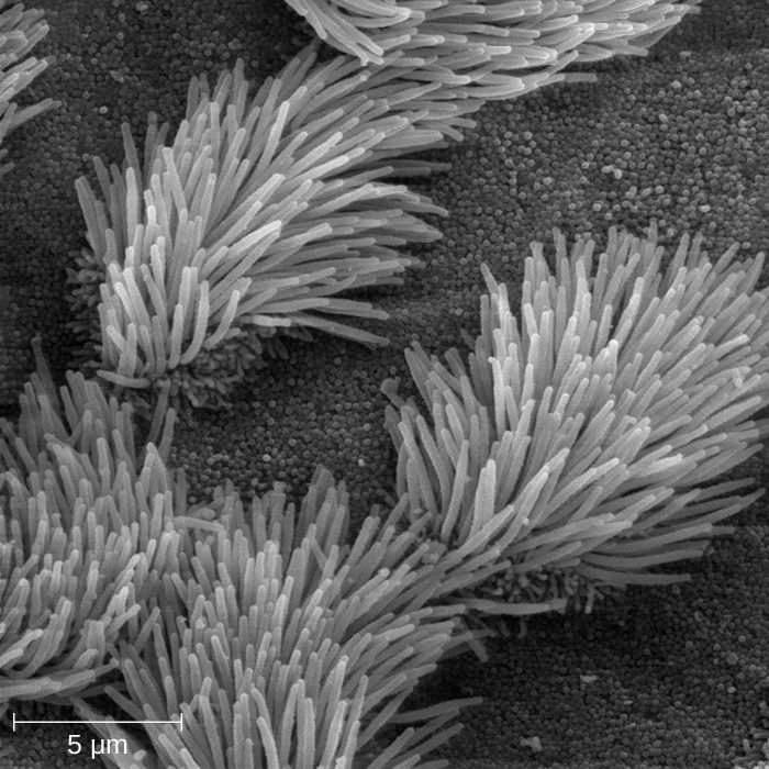 This scanning electron micrograph shows ciliated and nonciliated epithelial cells from the human trachea. The mucociliary escalator pushes mucus away from the lungs, along with any debris or microorganisms that may be trapped in the sticky mucus, and the mucus moves up to the esophagus where it can be removed by swallowing.