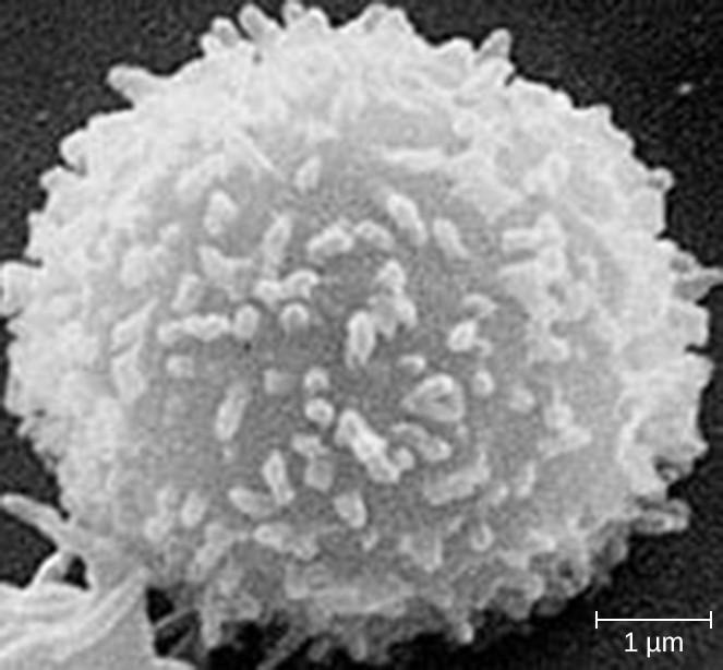 This scanning electron micrograph shows a T lymphocyte, which is responsible for the cell-mediated immune response. The spike-like membrane structures increase surface area, allowing for greater interaction with other cell types and their signals.