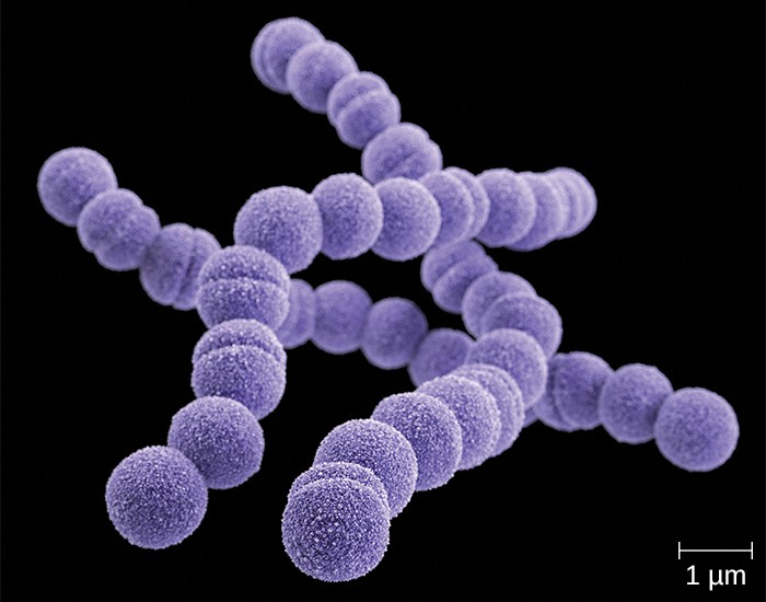 This scanning electron micrograph of Streptococcus pyogenes shows the characteristic cellular phenotype resembling chains of cocci.