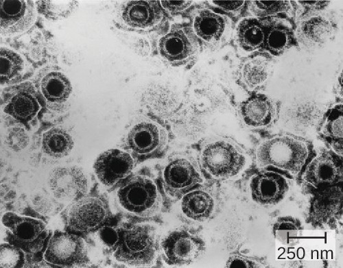 Virions of the herpes simplex virus are shown here in this transmission electron micrograph.