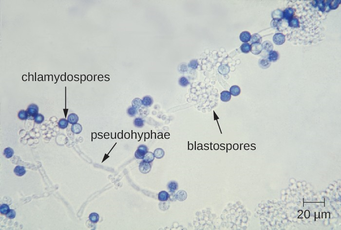 Candida blastospores (asexual spores that result from budding) and chlamydospores (resting spores produced through asexual reproduction) are visible in this micrograph.