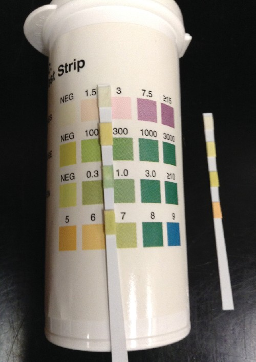 A urine dipstick is compared against a color key to determine levels of various chemicals, proteins, or cells in the urine. Abnormal levels may indicate an infection.