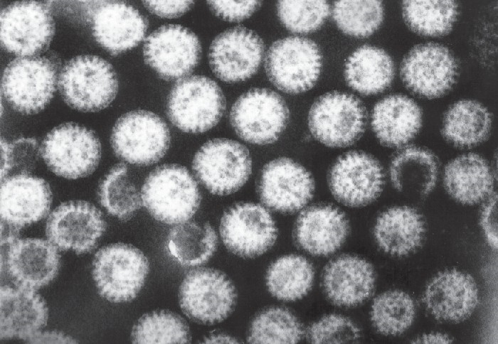 Rotaviruses in a fecal sample are visualized using electron microscopy.