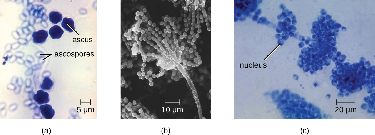 (a) This brightfield micrograph shows ascospores being released from asci in the fungus Talaromyces flavus var. flavus. (b) This electron micrograph shows the conidia (spores) borne on the conidiophore of Aspergillus, a type of toxic fungus found mostly in soil and plants. (c) This brightfield micrograph shows the yeast Candida albicans, the causative agent of candidiasis and thrush.